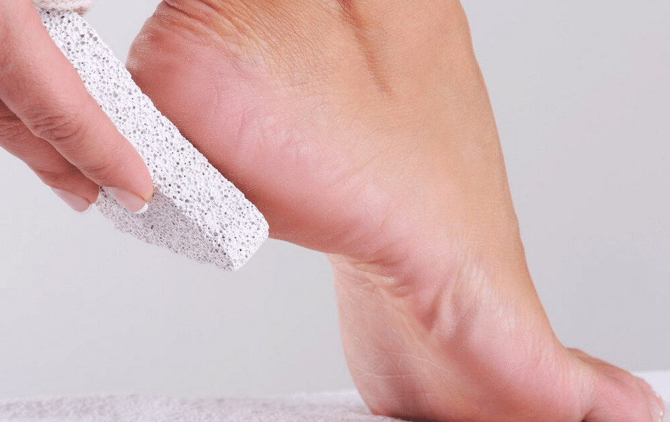 Foot Scrub & Callus Removal